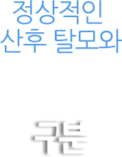 정상적인 산후 탈모와 비정상적인 산후 탈모의 구분