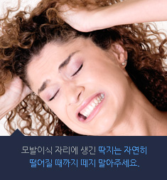 모발이식 자리에 생긴 딱지는 자연히 떨어질 때까지 떼지 말아주세요.