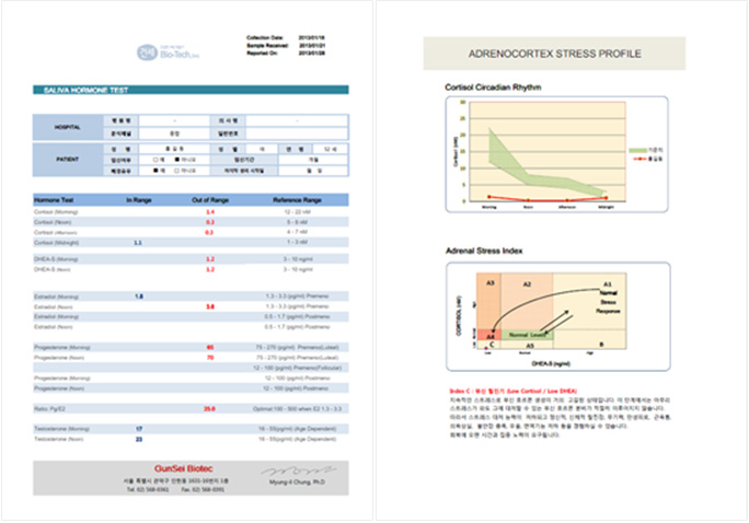 타액호르몬검사 결과지 예시