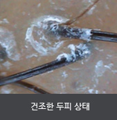 건조한 두피 상태 