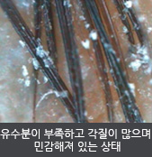 유수분이 부족하고 각질이 많으며  민감해져 있는 상태