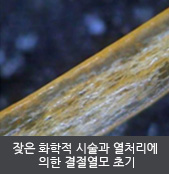 잦은 화학적 시술과 열처리에  의한 결절열모 초기