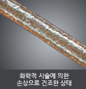 화학적 시술에 의한 손상으로 건조한 상태