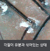 각질이 유분과 섞여있는 상태