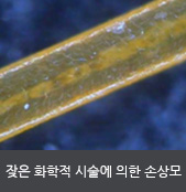 잦은 화학적 시술에 의한 손상모