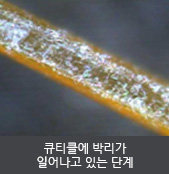 큐티클에 박리가 일어나고 있는 단계