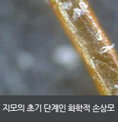 지모의 초기 단계인 화학적 손상모