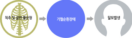 척추 및 골반 불균형 > 기혈순환장애 > 탈모발생