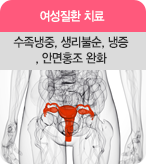 여성질환 치료 수족냉중, 생리불순, 냉증 , 안면홍조 완화